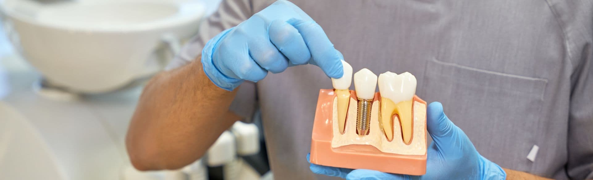 Your Guide to Dental Implants and a Brighter Smile