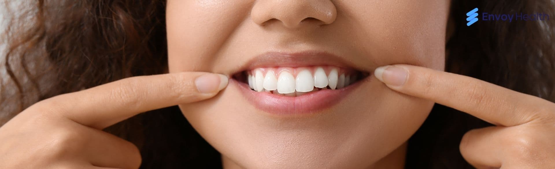 How Long Does it Take to Get Dental Implants in Mexico?