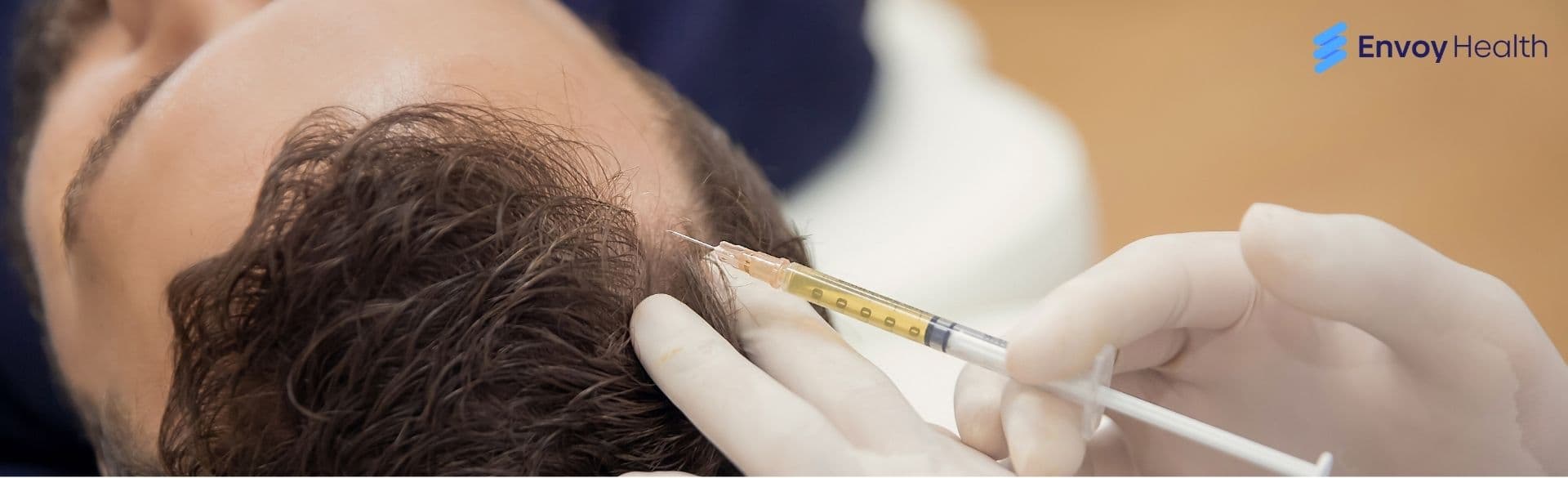 Hair Transplant Turkey: A Complete Guide From Start to Finish