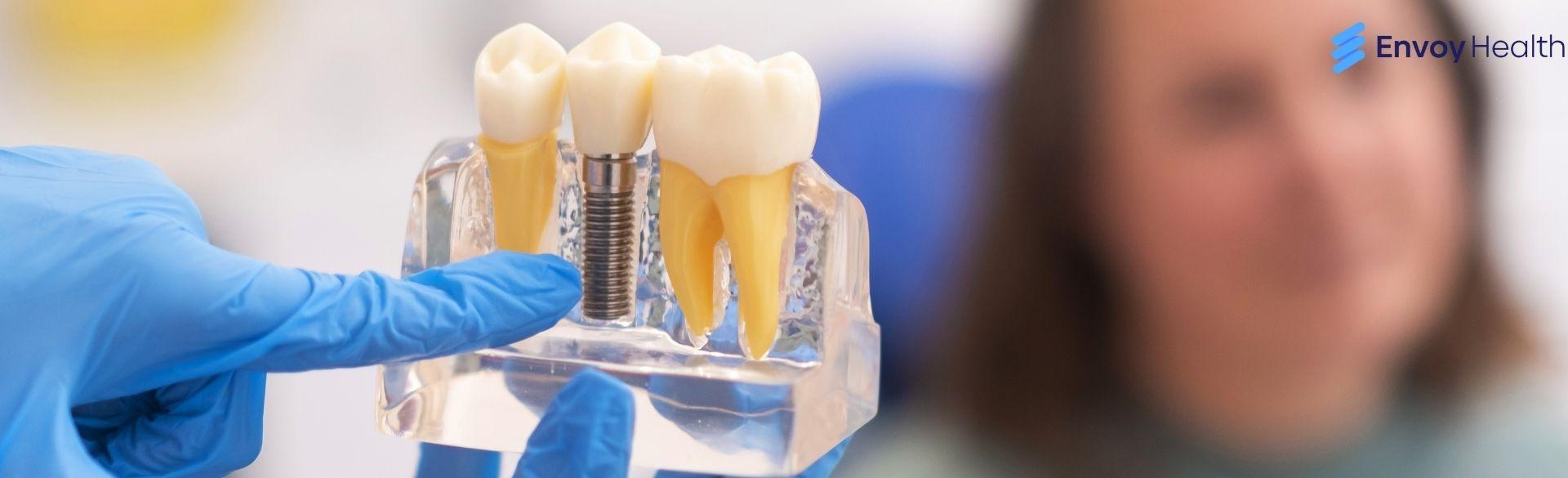 Cost of Dental Implants in Cancun Cost of Dental Implants in Cancun