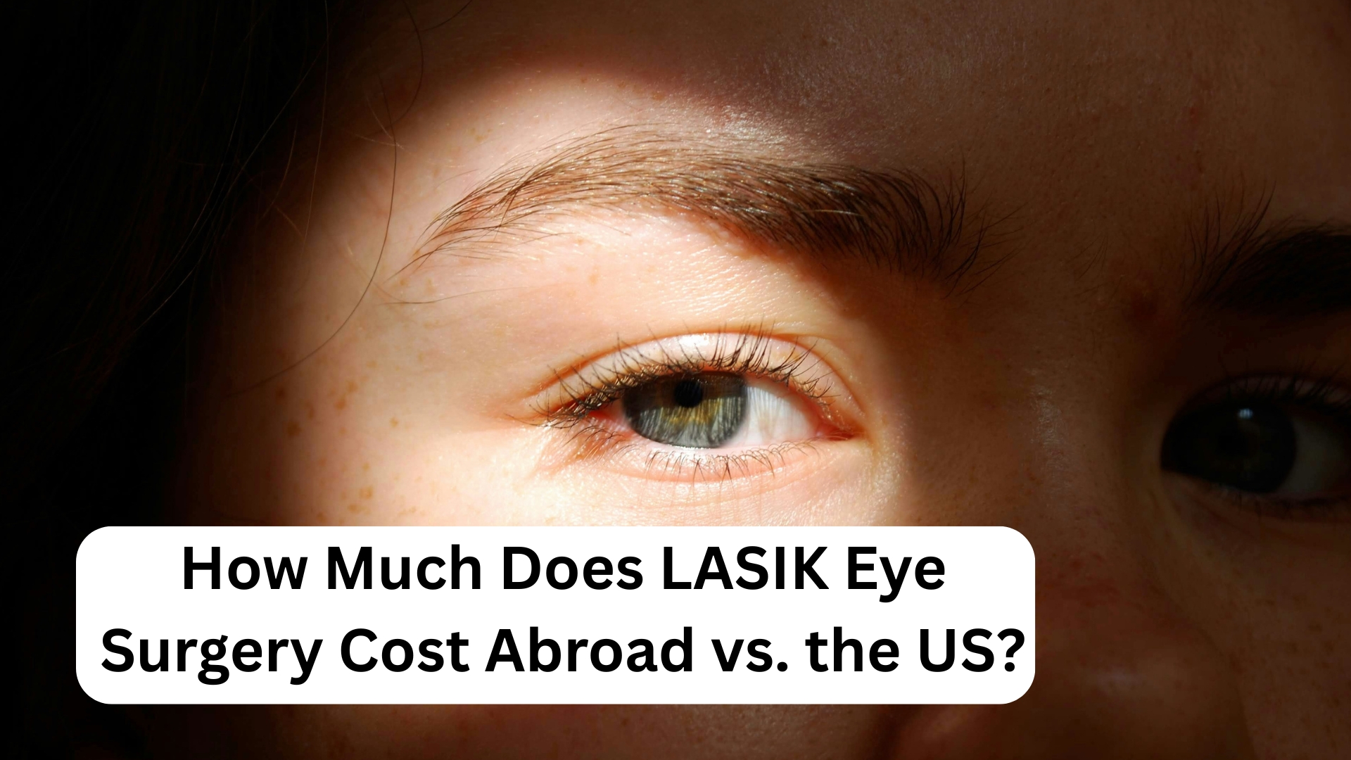 How Much Does LASIK Eye Surgery Cost Abroad vs. the US? How Much Does LASIK Eye Surgery Cost Abroad vs. the US?