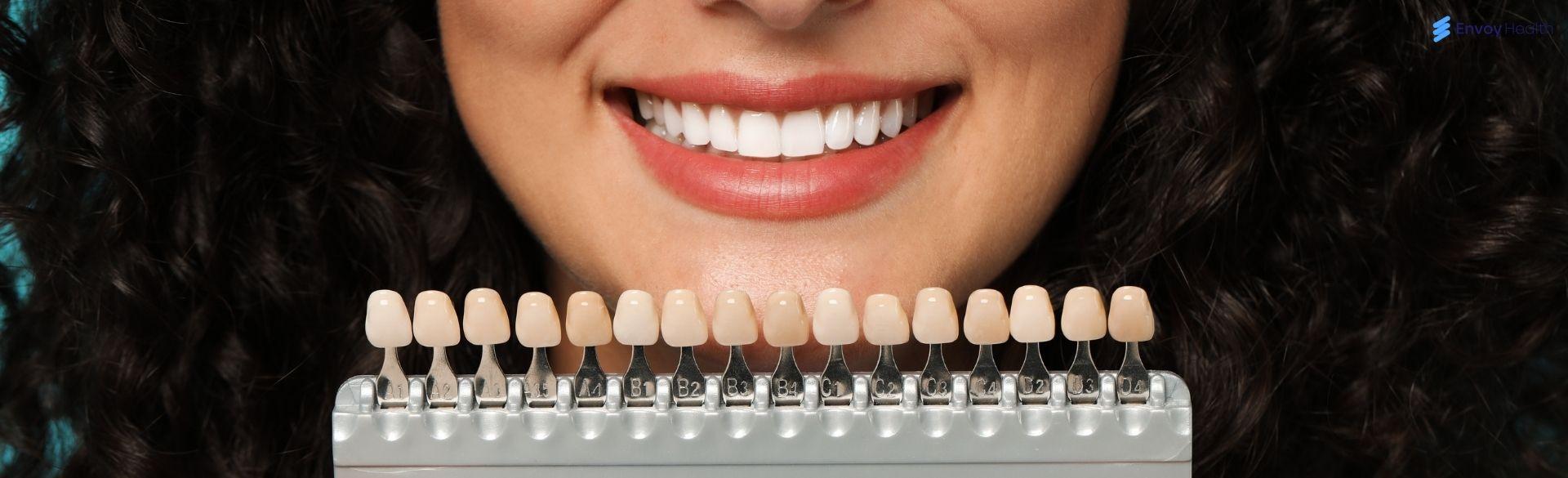 The Truth About What Happens to Your Teeth Underneath Veneers The Truth About What Happens to Your Teeth Underneath Veneers