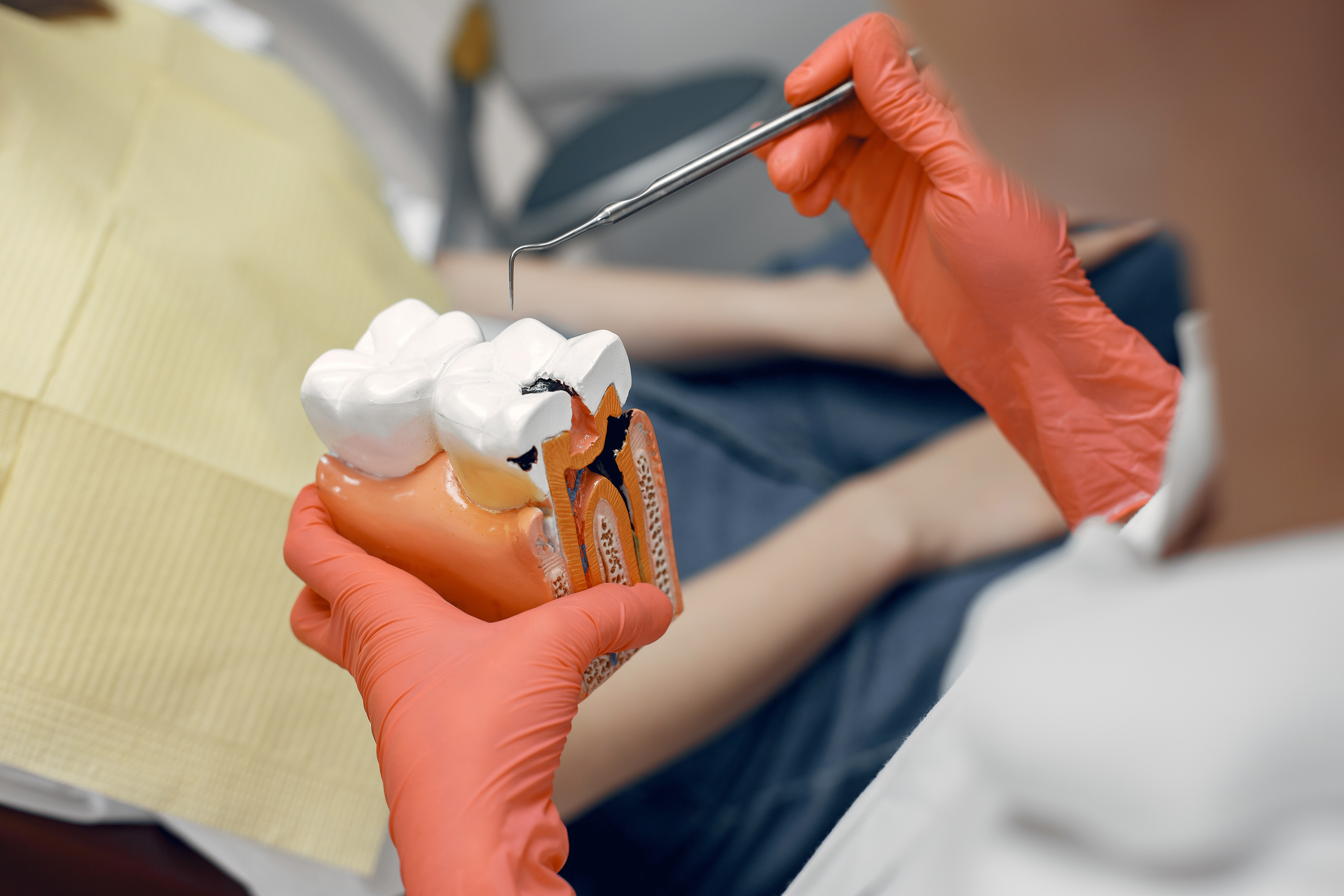 Dental care guide explaining tooth decay treatment and cavity prevention Dental care guide explaining tooth decay treatment and cavity prevention