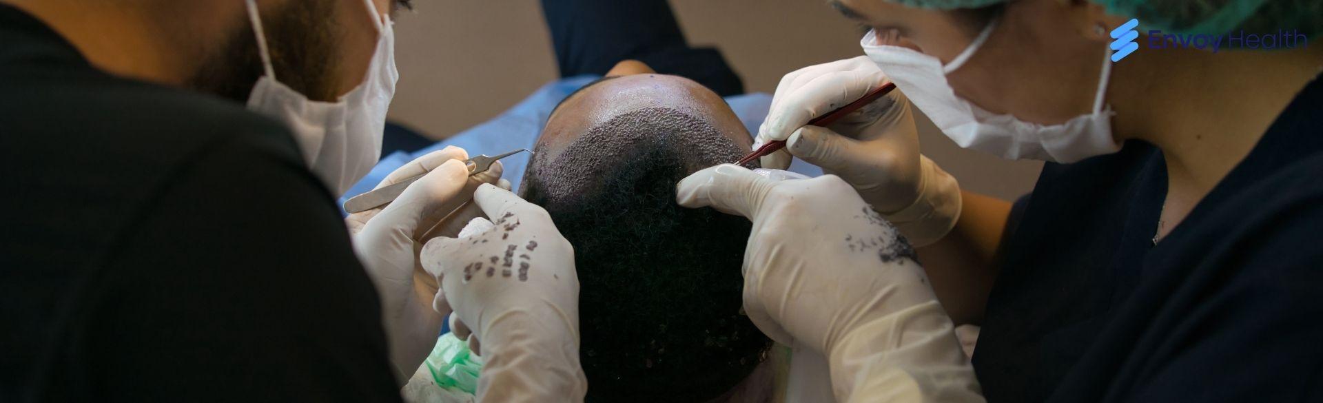 Top 5 Best Hair Transplants in Turkey Top 5 Best Hair Transplants in Turkey
