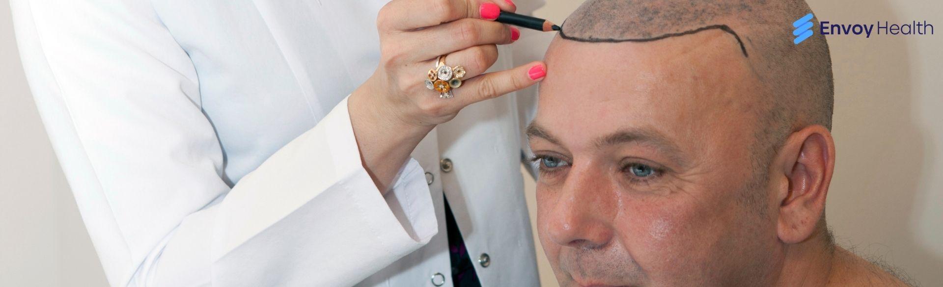 How Much Do Hair Implants Cost in Turkey?