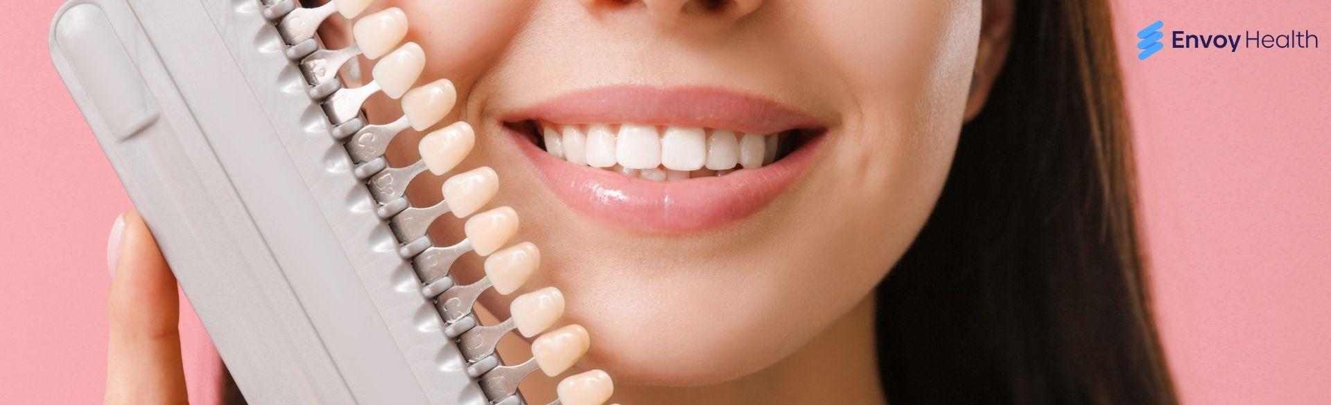 Veneer Teeth in Mexico: Smart Choice for Picture-Perfect Smile Veneer Teeth in Mexico: Smart Choice for Picture-Perfect Smile